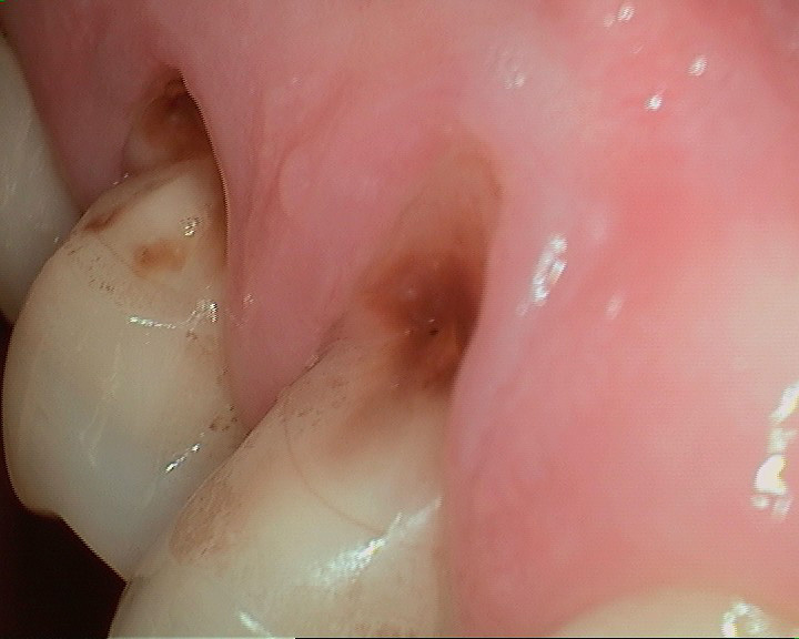 Image showing stains on teeth